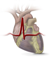 SUS implanta 35 mil pontes e 44 mil stents